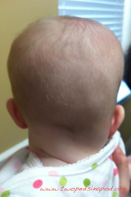 Tummy time can prevent flat head syndrome, or plagiocephaly